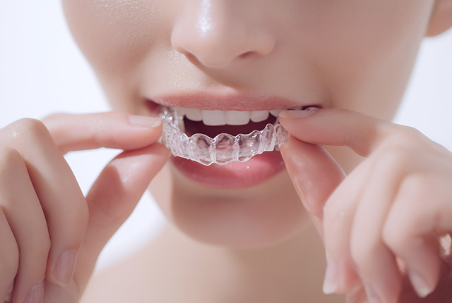 マウスピース矯正